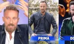 Francesco Facchinetti verrät das Mittel gegen Haarausfall: „Ich habe Frieden mit einem Hautpflaster gefunden“